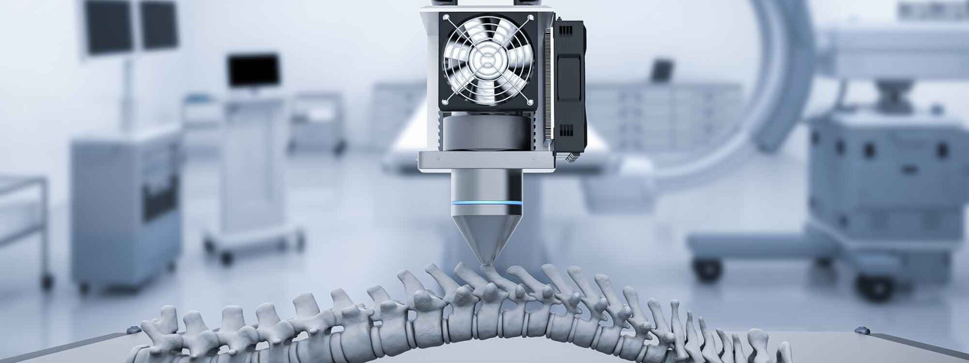 3D geprint medisch implantaat